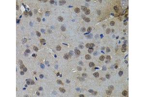 Immunohistochemistry of paraffin-embedded Rat brain using IL33 Polyclonal Antibody (IL-33 Antikörper)