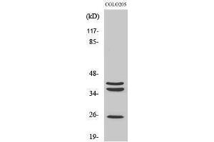 Western Blotting (WB) image for anti-Cathepsin B (CTSB) (Internal Region) antibody (ABIN3183690) (Cathepsin B Antikörper  (Internal Region))