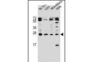 EDN1 Antibody (C-term) (ABIN655912 and ABIN2845311) western blot analysis in ZR-75-1,,MDA-M,A549 cell line lysates (35 μg/lane). (Endothelin 1 Antikörper  (C-Term))