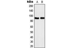 Western blot analysis of Kanadaptin expression in A431 (A), Jurkat (B) whole cell lysates. (NADAP Antikörper  (Center))