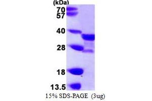 SDS-PAGE (SDS) image for N-Acetyltransferase 1 (Arylamine N-Acetyltransferase) (NAT1) (AA 1-290) protein (His tag) (ABIN667924)