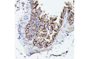 Immunohistochemistry of paraffin-embedded mouse lung using VD Rabbit pAb (ABIN6130775, ABIN6150077, ABIN6150078 and ABIN6214830) at dilution of 1:25 (40x lens). (VDAC3 Antikörper  (AA 1-283))