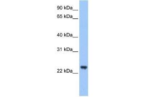 Western Blot showing TRIM48 antibody used at a concentration of 1-2 ug/ml to detect its target protein. (TRIM48 Antikörper  (C-Term))