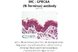 Image no. 2 for anti-G Protein-Coupled Receptor, Family C, Group 6, Member A (GPRC6A) (Extracellular Domain), (N-Term) antibody (ABIN1735226) (GPRC6A Antikörper  (Extracellular Domain, N-Term))