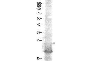 Western Blot (WB) analysis of AD-293 cells using Acetyl-NF-E4 (K43) Polyclonal Antibody. (NFE4 Antikörper  (acLys43))