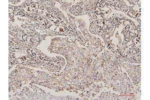 IHC analysis of LPP using anti-LPP antibody (ABIN7599606). (LPP Antikörper  (AA 10-572))