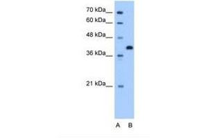 Image no. 1 for anti-Torsin Family 2, Member A (TOR2A) (AA 51-100) antibody (ABIN341411)