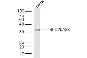 Mouse bone lysates probed with SLC25A38 Polyclonal Antibody, Unconjugated  at 1:300 dilution and 4˚C overnight incubation.