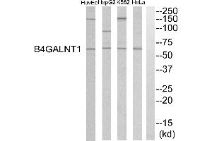 Western blot analysis of extracts from HeLa cells, K562 cells, HepG2 cells and HuvEC cells, using B4GALNT1 antibody. (B4GALNT1 Antikörper)