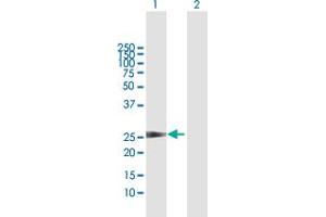 Western Blot analysis of CCBE1 expression in transfected 293T cell line by CCBE1 MaxPab polyclonal antibody. (CCBE1 Antikörper  (AA 1-215))