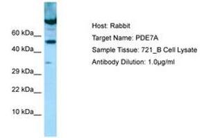 Image no. 1 for anti-phosphodiesterase 7A (PDE7A) (AA 338-387) antibody (ABIN6749987) (PDE7A Antikörper  (AA 338-387))