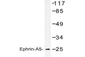 Western blot analysis of Ephrin-A5 antibody in extracts from HeLa cells. (Ephrin A5 Antikörper)