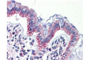 IMPDH1 antibody was used for immunohistochemistry at a concentration of 4-8 ug/ml. (IMPDH1 Antikörper)