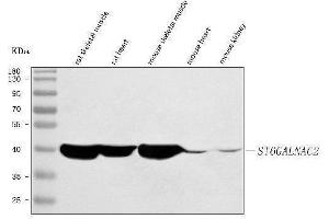 Western blot analysis of ST6GALNAC2 using anti-ST6GALNAC2 antibody (ABIN7601307).