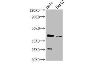 Western Blot Positive WB detected in: Hela whole cell lysate, HepG2 whole cell lysate All lanes: CD72 antibody at 3. (CD72 Antikörper  (AA 150-208))