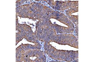 IHC analysis of Scavenging Receptor SRB2/SCARB2 using anti-Scavenging Receptor SRB2/SCARB2 antibody (ABIN7601833).