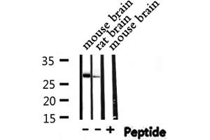 Western blot analysis of THOC4 expression in various lysates (THO Complex 4 Antikörper  (Internal Region))