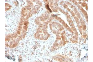 Immunohistochemistry (IHC) image for anti-V-Akt Murine Thymoma Viral Oncogene Homolog 1 (AKT1) (AA 85-189) antibody (ABIN6939338)
