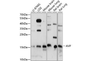 Western blot analysis of extracts of various cell lines, using AVP antibody (ABIN7265664) at 1:1000 dilution. (Vasopressin Antikörper  (AA 20-164))