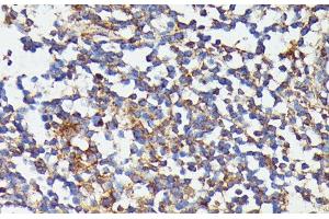 Immunohistochemistry of paraffin-embedded Human colon using CSF3 Polyclonal Antibody at dilution of 1:100 (40x lens). (G-CSF Antikörper)
