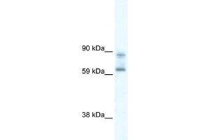WB Suggested Anti-DDX42 Antibody Titration:  0. (DDX42 Antikörper  (N-Term))