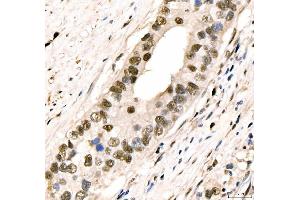 IHC analysis of CRTC3 using anti-CRTC3 antibody (ABIN7599779). (CRTC3 Antikörper  (AA 116-619))