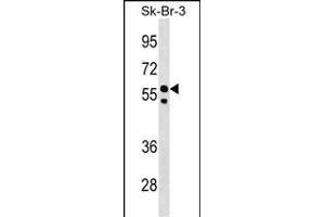 FBXO31 Antibody (Center) (ABIN1538289 and ABIN2848716) western blot analysis in SK-BR-3 cell line lysates (35 μg/lane). (FBXO31 Antikörper  (AA 310-338))