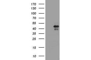 Image no. 1 for anti-TIA1 Cytotoxic Granule-Associated RNA Binding Protein (TIA1) antibody (ABIN1501388) (TIA1 Antikörper)