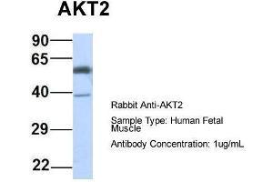 Host: Rabbit  Target Name: AKT2  Sample Tissue: Human Fetal Muscle  Antibody Dilution: 1. (AKT2 Antikörper  (Middle Region))