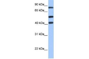 Human Jurkat; WB Suggested Anti-HCFC2 Antibody Titration: 0. (HCFC2 Antikörper  (C-Term))