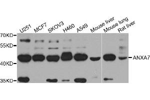 Western Blotting (WB) image for anti-Annexin A7 (ANXA7) (AA 237-466) antibody (ABIN1678673) (Annexin VII Antikörper  (AA 237-466))