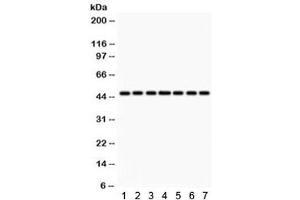 Western blot testing of 1) rat lung, 2) rat kidney, 3) rat brain, 4) human HeLa, 5) SMMC, 6) A549 and 7) mouse NIH3T3 lysate with IDH1 antibody.