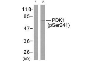 Western blot analysis of extracts from MDA-MB-435 cells using PDK1 (phospho-Ser241) antibody (E011005). (PDPK1 Antikörper  (pSer241))