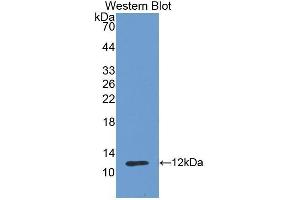 Western Blotting (WB) image for anti-Cadherin 1, Type 1, E-Cadherin (Epithelial) (CDH1) (AA 784-870) antibody (ABIN3209722) (E-cadherin Antikörper  (AA 784-870))