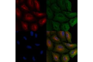 ABIN6265678 and ABIN6266689 staining  cells by IF/ICC. (TP53I11 Antikörper  (N-Term))