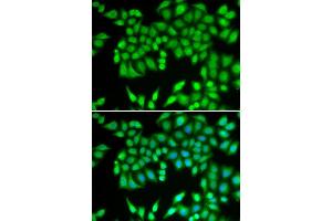 Immunofluorescence (IF) image for anti-Minichromosome Maintenance Complex Component 3 (MCM3) (AA 1-295) antibody (ABIN3021327) (MCM3 Antikörper  (AA 1-295))