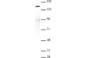 SMC1- α antibody (pAb) tested by Immunoprecipitation. (SMC1A Antikörper  (C-Term))