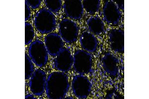 Immunofluorescence (IF) image for anti-Vimentin (VIM) (AA 325-375) antibody (ABIN7449539) (Rekombinanter Vimentin Antikörper  (AA 325-375))