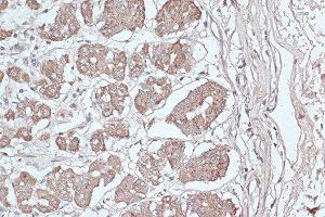 Immunohistochemistry of paraffin-embedded human stomach using MAP1LC3B antibody. (LC3B Antikörper)