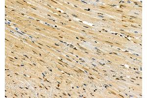 ABIN6259720 and ABIN6279067 at 1/100 staining Rat heart tissue by IHC-P. (ACBD7 Antikörper  (Internal Region))