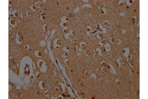 IHC image of ABIN7146439 diluted at 1:200 and staining in paraffin-embedded human brain tissue performed on a Leica BondTM system. (CAMK2A Antikörper  (AA 321-478))