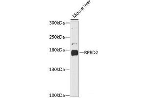 Western blot analysis of extracts of Mouse liver using RPRD2 Polyclonal Antibody at dilution of 1:3000. (RPRD2 Antikörper)