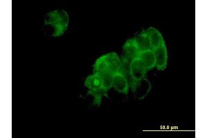 Immunofluorescence of monoclonal antibody to DNPEP on MCF-7 cell. (Aspartyl Aminopeptidase Antikörper  (AA 1-475))