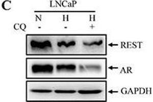 Western Blotting (WB) image for anti-Glyceraldehyde-3-Phosphate Dehydrogenase (GAPDH) antibody (ABIN2857072)