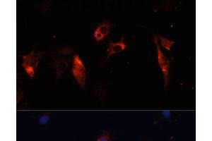 Immunofluorescence analysis of C6 cells using CTSL Polyclonal Antibody at dilution of 1:100. (Cathepsin L Antikörper)