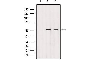 Western blot analysis of extracts from various samples, using DMAP1 Antibody. (DMAP1 Antikörper  (Internal Region))