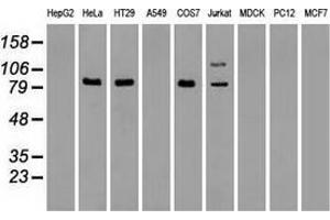 Western blot analysis of extracts (35 µg) from 9 different cell lines by using anti-anti-BRAFmonoclonal antibody. (BRAF Antikörper)