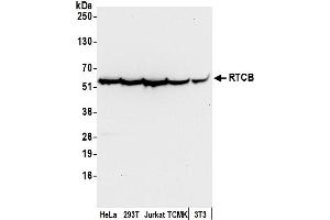 anti-tRNA-Splicing Ligase RtcB Homolog (RTCB) (AA 455-505) antibody