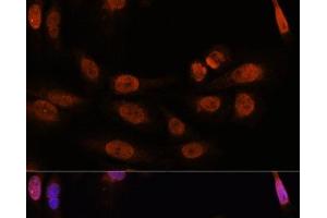 Immunofluorescence analysis of U-2 OS cells using THRB Polyclonal Antibody at dilution of 1:100. (THRB Antikörper)