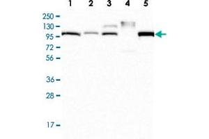 Western Blot analysis of Lane 1: RT-4 cell lysate, Lane 2: U-251 MG, Lane 3: Human plasma, Lane 4: Human Liver tissue, Lane 5: Human Tonsil tissue with APOB polyclonal antibody  at 1:250 - 1:500 dilution.
